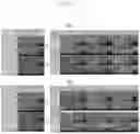 Fig. 06 - Manufacturing method of surface-treated zinc-nickel alloy electroplated steel sheet having excellent corrosion resistivity and paintability