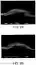 Fig. 07 - Smooth and bulky tissue