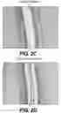 Fig. 04 - Tissue products formed from multi-apex emboss elements and methods for producing the same
