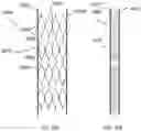 Fig. 35 - Variable thermal insulation assembly
