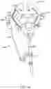Fig. 08 - Ladder stabilizing system and method