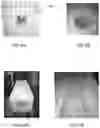Fig. 05 - Laser tool with purging head