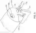 Fig. 11 - Bottom hole assembly with a cleaning tool