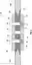 Fig. 04 - Hybrid metal composite structures, joint structures, and related methods