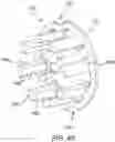 Fig. 07 - Flexible reinforced radial spline coupling and method