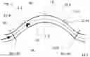 Fig. 02 - METHOD FOR OPERATING A CORIOLIS MEASURING DEVICE, AND CORIOLIS MEASURING DEVICE