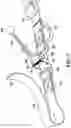 Fig. 06 - QUICK-RELEASE EXTENSION FOR A PET LEASH