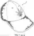 Fig. 02 - Hat brim technology