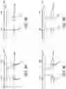 Fig. 08 - Apparatus, systems, and methods for vision assessment and treatment