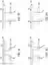 Fig. 09 - Apparatus, systems, and methods for vision assessment and treatment