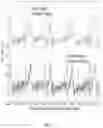 Fig. 02 - Electrocardiogram signal detection