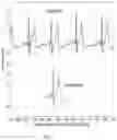 Fig. 08 - Electrocardiogram signal detection