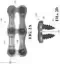 Fig. 03 - MEDICAL IMPLANT SYSTEMS AND METHODS OF USE THEREOF