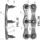 Fig. 04 - MEDICAL IMPLANT SYSTEMS AND METHODS OF USE THEREOF