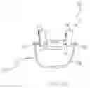 Fig. 14 - Stable affixation system for guided dental implantation