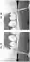 Fig. 06 - Method for contouring a dental restoration
