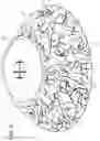 Fig. 08 - In vivo tissue engineering devices, methods and regenerative and cellular medicine employing scaffolds made of absorbable material