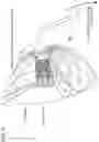 Fig. 09 - In vivo tissue engineering devices, methods and regenerative and cellular medicine employing scaffolds made of absorbable material