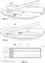 Fig. 04 - CATHETER