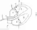 Fig. 02 - Device and method for releasing catheters from cardiac structures