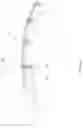 Fig. 08 - Device and method for releasing catheters from cardiac structures