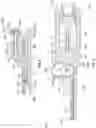 Fig. 09 - PROBE DELIVERY DEVICE TO FACILITATE THE ADVANCEMENT AND RETRACTION OF A PROBE WITHIN AN INTRAVENOUS CATHETER