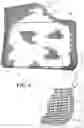 Fig. 06 - LVAD FIXATION AND INFECTION MANAGEMENT