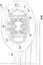 Fig. 09 - URINARY INCONTINENCE TREATMENT DEVICE AND METHOD FOR USING THE SAME