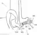 Fig. 01 - Hidden cochlear implant system