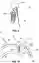 Fig. 08 - Hidden cochlear implant system