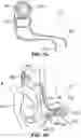 Fig. 11 - Hidden cochlear implant system