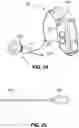 Fig. 15 - Hidden cochlear implant system