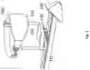 Fig. 03 - Protective rowing device