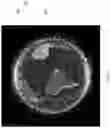 Fig. 02 - Debris collecting apparatus and related method