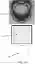 Fig. 33 - Systems and methods for sealing a container