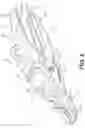 Fig. 03 - Spring steel sleeve design
