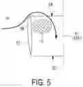 Fig. 06 - DUCTED FAN DEVICE AND AIRCRAFT