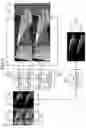 Fig. 07 - Medical image processing device and medical observation system