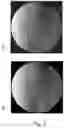 Fig. 04 - Determination of imaging direction based on a 2D projection image
