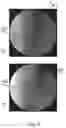 Fig. 05 - Determination of imaging direction based on a 2D projection image