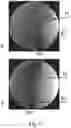 Fig. 06 - Determination of imaging direction based on a 2D projection image