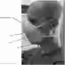 Fig. 01 - Protective shield for individual respirators and face masks