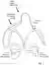 Fig. 02 - IN-EAR CUSTOM BIOMETRIC HEARABLE AND METHOD OF MANUFACTURE