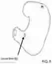 Fig. 09 - IN-EAR CUSTOM BIOMETRIC HEARABLE AND METHOD OF MANUFACTURE