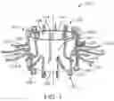 Fig. 02 - Prosthetic heart valve