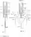 Fig. 04 - Prosthetic heart valve