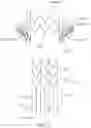 Fig. 16 - Prosthetic heart valve