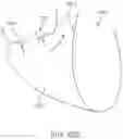 Fig. 32 - Prosthetic heart valve