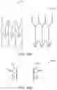 Fig. 47 - Prosthetic heart valve
