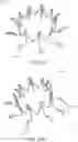 Fig. 79 - Prosthetic heart valve